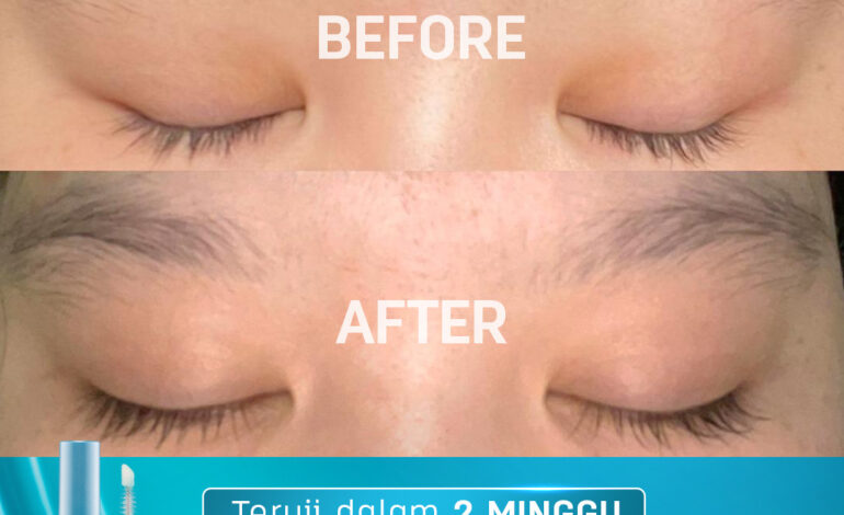 Multi-Peptide Lash & Brow Serum dengan Formula Inovatif Dari Erhair Lashbooster